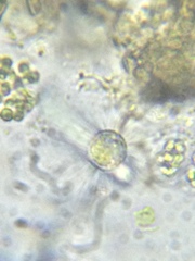 Acanthocystis