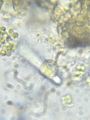 Acanthocystis