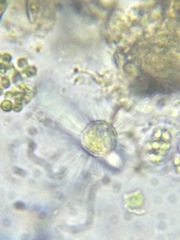Acanthocystis