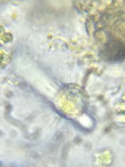 Acanthocystis