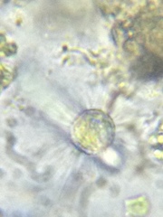 Acanthocystis