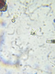 Amoebozoa