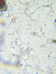 Amoebozoa