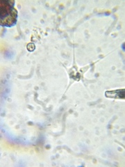 Amoebozoa