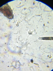 Amoebozoa