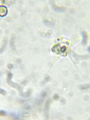 Amoebozoa