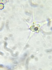 Amoebozoa