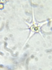 Amoebozoa
