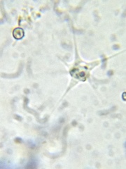 Amoebozoa