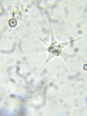 Amoebozoa