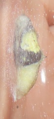 Belenois creona severina
