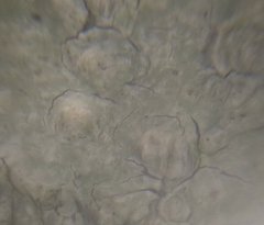 Pertusaria leioplaca