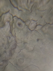 Pertusaria leioplaca