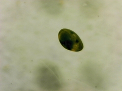 Ostracoda