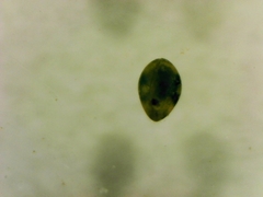 Ostracoda