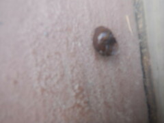 Planorbella trivolvis