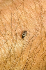 Hyalochilus ovatulus