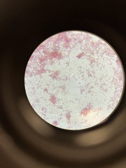 Enterobacteriaceae