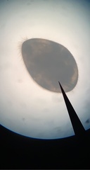 Ostracoda