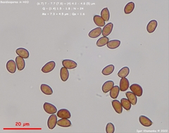 Lacrymaria echiniceps