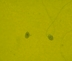 Ostracoda