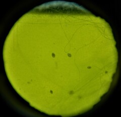 Ostracoda