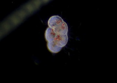 Protozoa