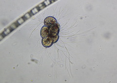 Protozoa