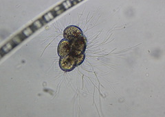 Protozoa