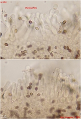 Lacrymaria echiniceps