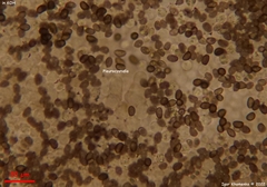 Lacrymaria echiniceps