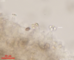 Lacrymaria echiniceps