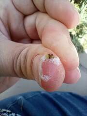 Cercopoidea