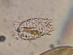 Euglypha acanthophora