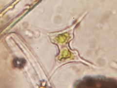 Staurodesmus extensus