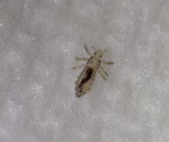 Pediculus humanus capitis