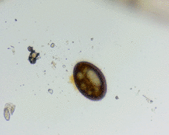 Cocconeis