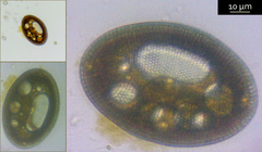 Cocconeis