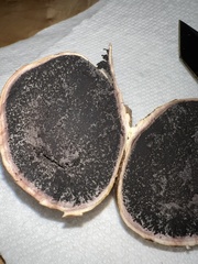 Scleroderma cepa