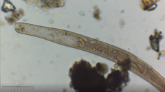 Spirostomum