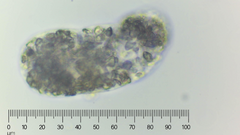 Amoebozoa