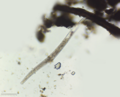 Spirostomum