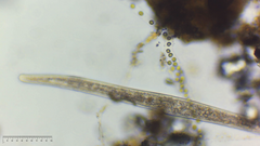 Spirostomum
