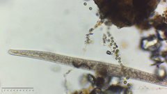 Spirostomum