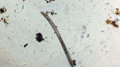 Nematoda