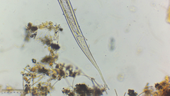 Nematoda