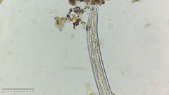 Nematoda