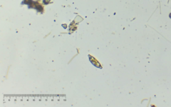 Encyonopsis microcephala