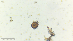 Arcella gibbosa