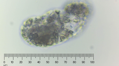 Amoebozoa